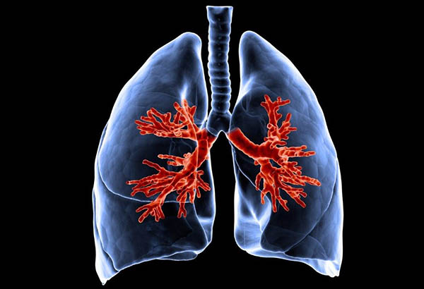 Pulmões com brônquios em evidência