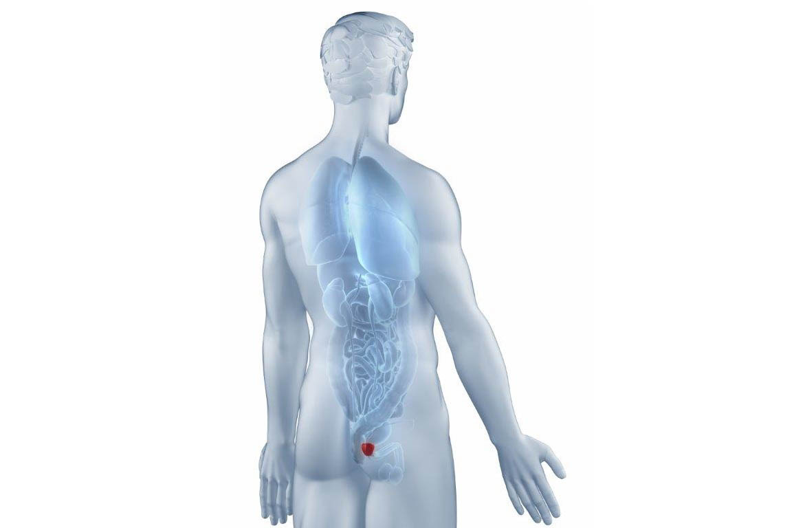 prostatitis a harmadik napon)