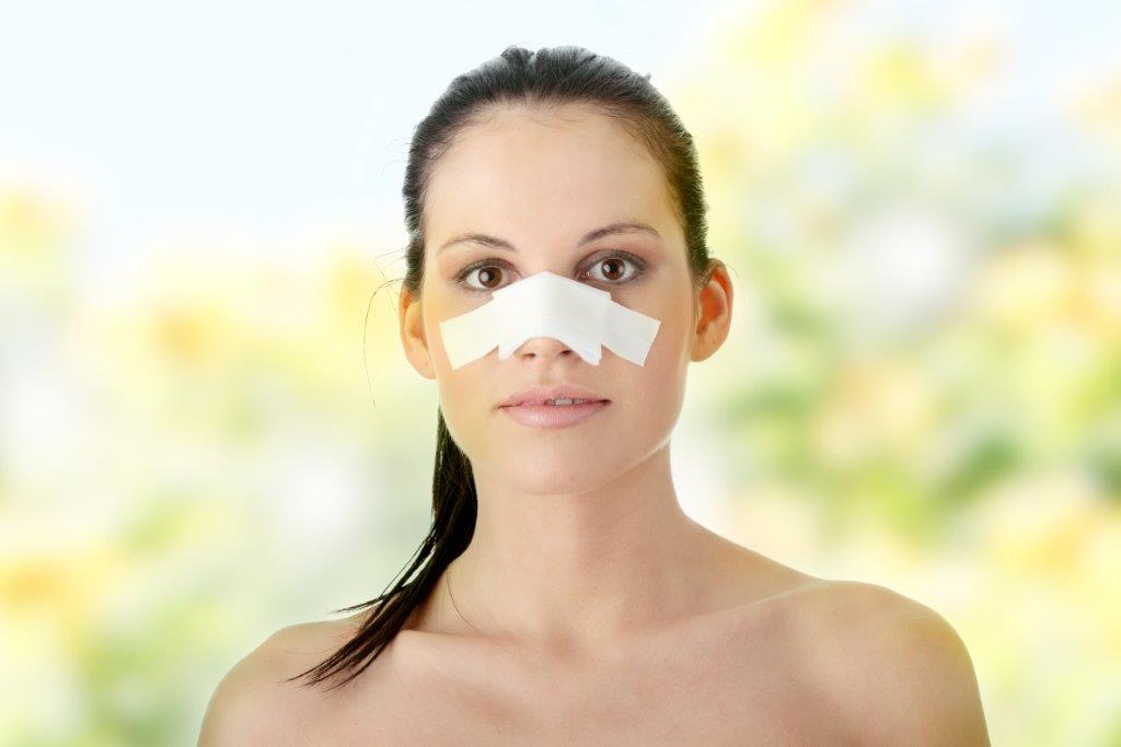 Impantes ou enxertos na rinoplastia