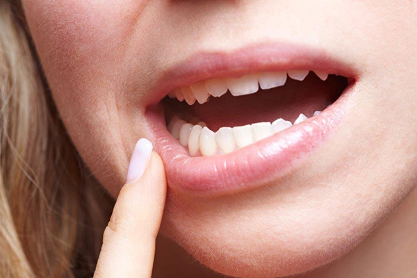Mulher a apontar para um dente