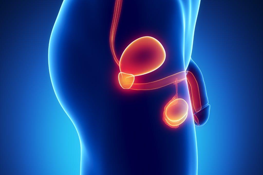 Hipertrofie benignă de prostată | Urologie | SANADOR