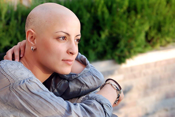 Mulher sem cabelo devido a quimioterapia