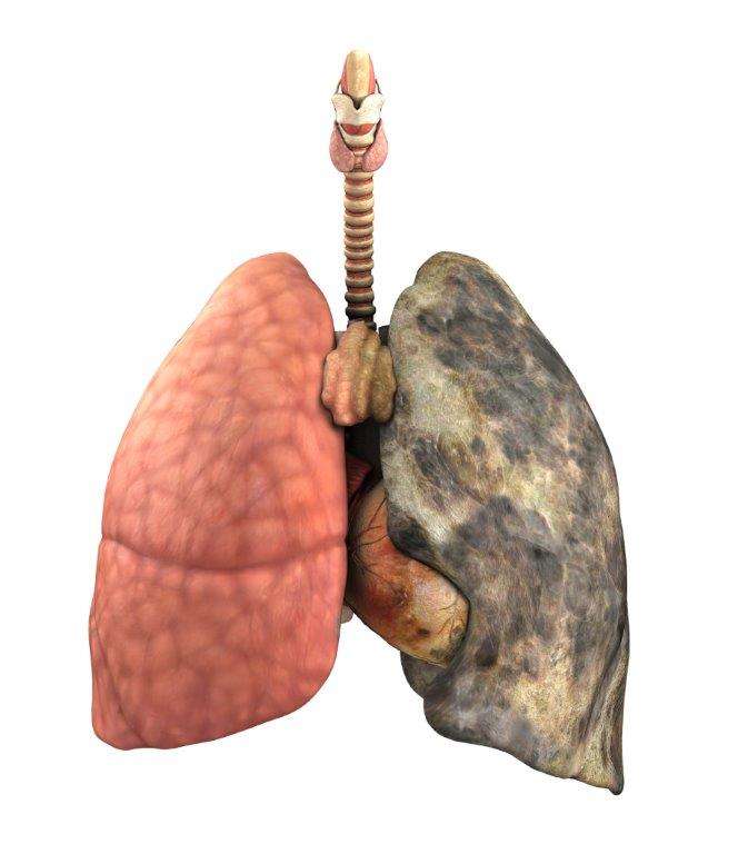Mostrar efeitos do tabaco nos pulmões com máquina | Atlas da Saúde