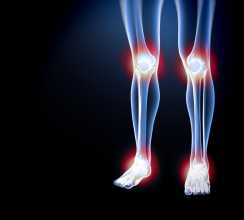 Osteoartrose