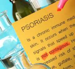 Papel a dizer psoriasis
