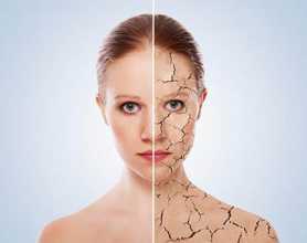 Mulher com problema de pele para ilustrar o xeroderma pigmentoso