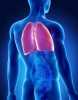 Hipertensão pulmonar
