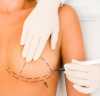 Cirurgião a desenhar marcas em peito de mulher
